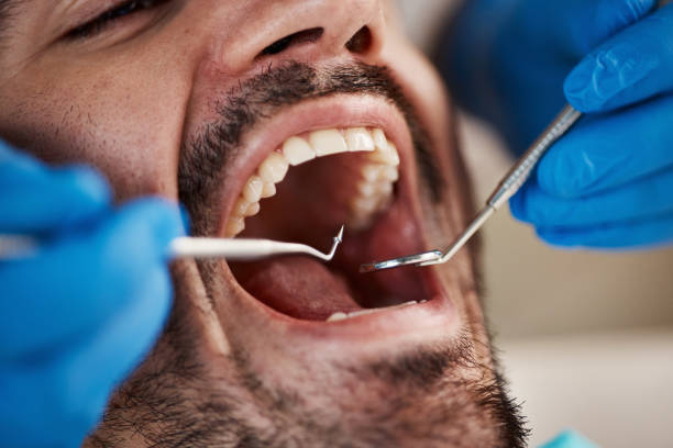 Best Walk-In Emergency Dental Services in Hobart, OK